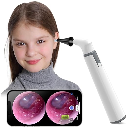 ScopeAround ScopeAround Otoscope with Light, Otoscope Camera w/Dual View, 720pHD WiFi Ear Scope w/ 6 LED Lights, Ear Camera 3.9mm Lens for Kids & Adults, Ear Scope Compatible w/Android & iPhone skincare