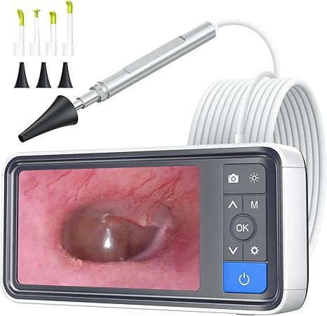 ScopeAround ScopeAround Otoscope with 4.5" IPS Screen, 3.9mm Ear Camera with Gyroscope, No App Needed Ear Wax Removal Tool with Light, 32GB Card, Easy to Use Digital Ear Scope for Safe Home Ear Checker skincare