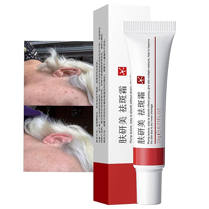 Generic Generic Crema para Manchas Oscuras en La Cara, Dark Spot Remover for Face, Freckles Melasma Brown Spot Corrector for Men Women, Crema para Las Manchas de La Cara 20G skincare